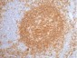 CD20 Monoclonal Antibody(2F4)